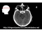 Tomografia axial cérebro 4