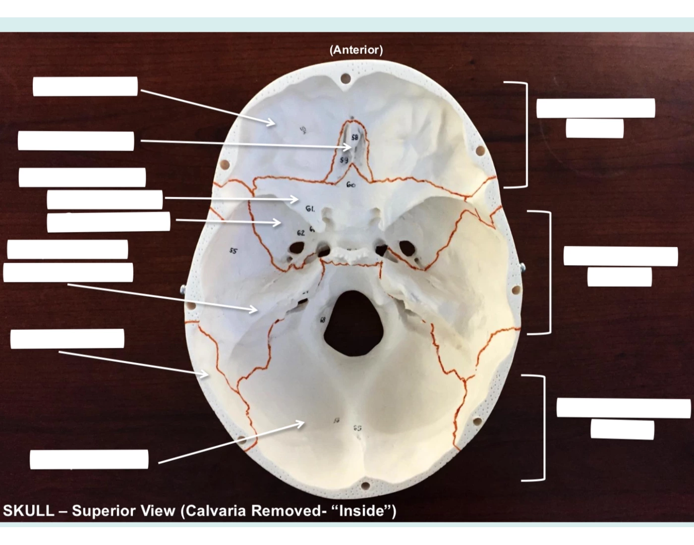 Skull - Superior View Quiz