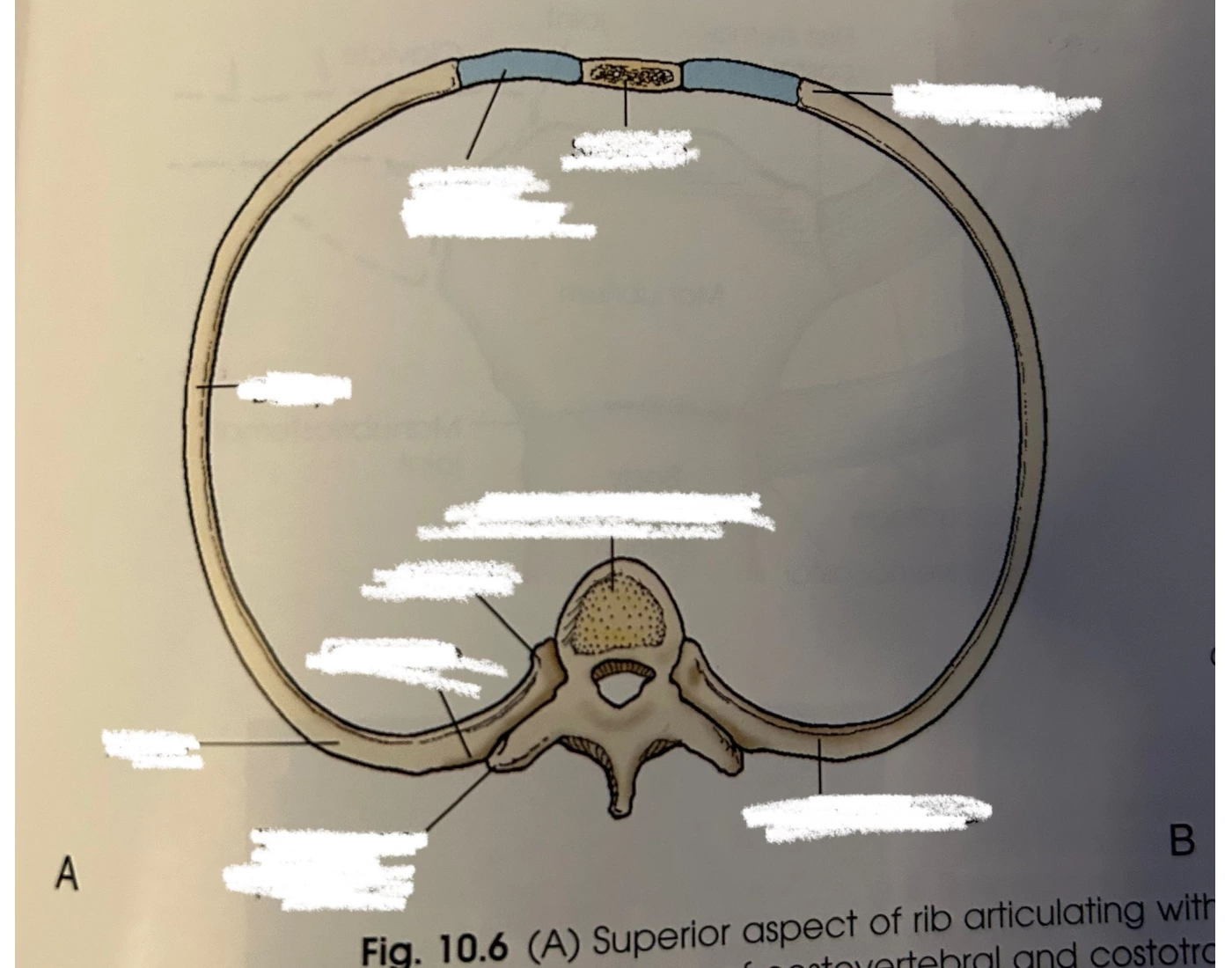 Superior Aspect of Rib + Articulations — Printable Worksheet