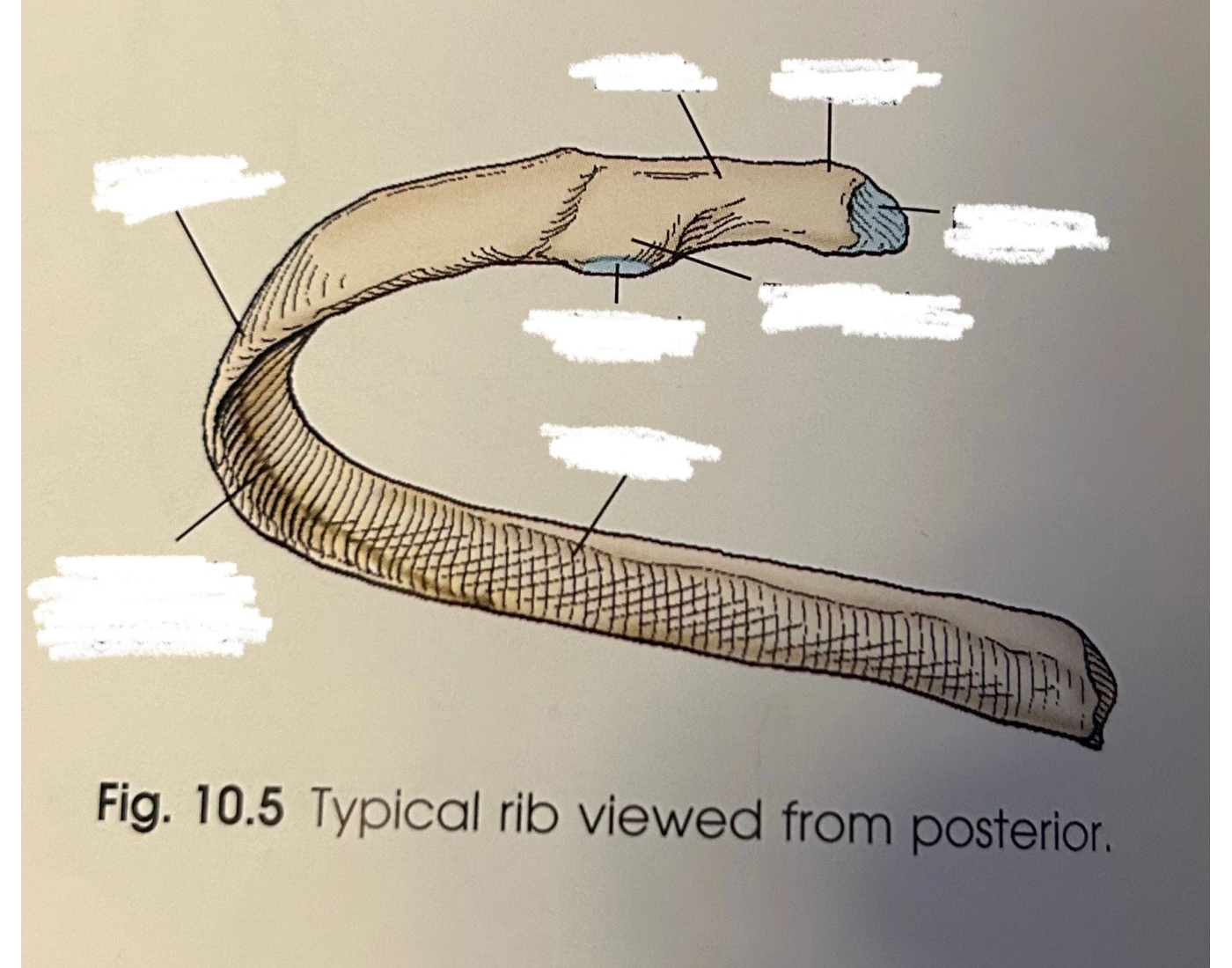 Video Game Ribs Typical Rib Viewed from Posterior — Printable Worksheet