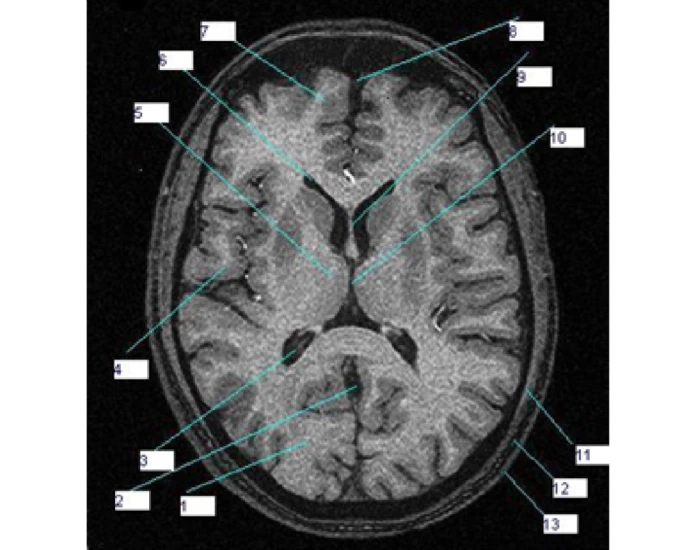 MRI T1 Axial brain anatomy — Printable Worksheet