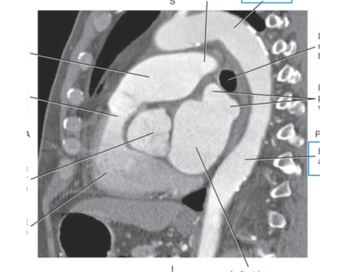 Ct Scan Worksheet.pdf CT Chest (Sagittal) — Printable Worksheet