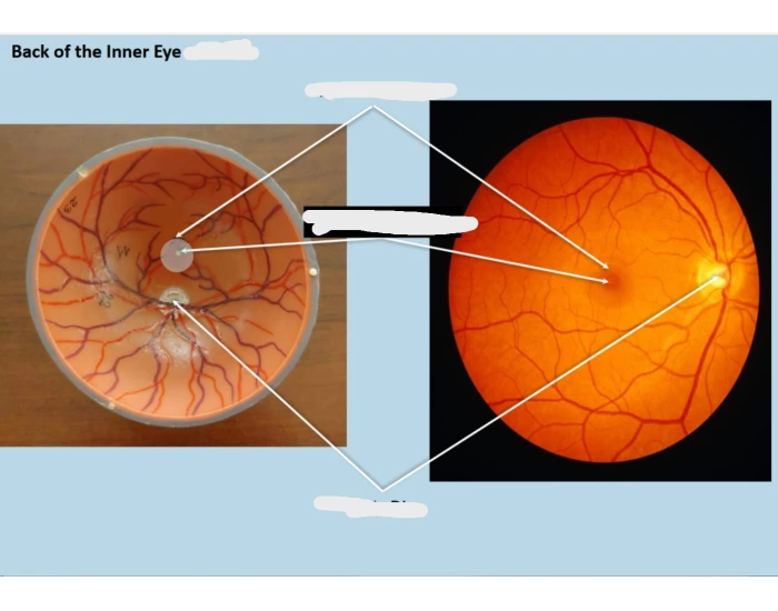Wars Inner Eye Back of inner eye Quiz