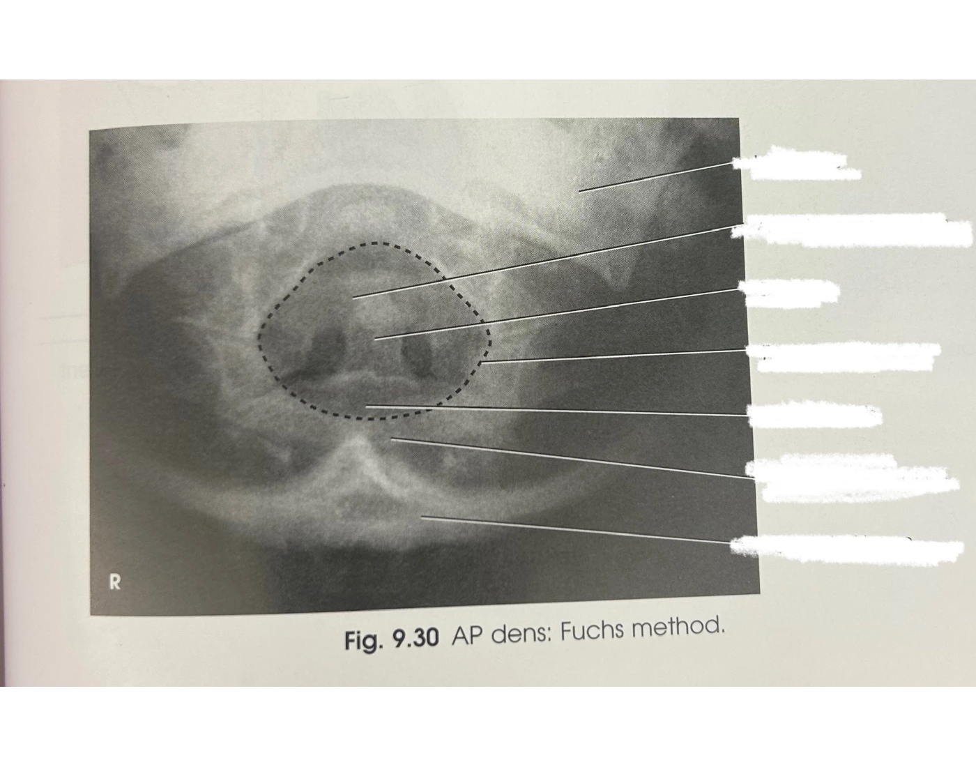 AP Dens (Fuchs) X-Ray Quiz