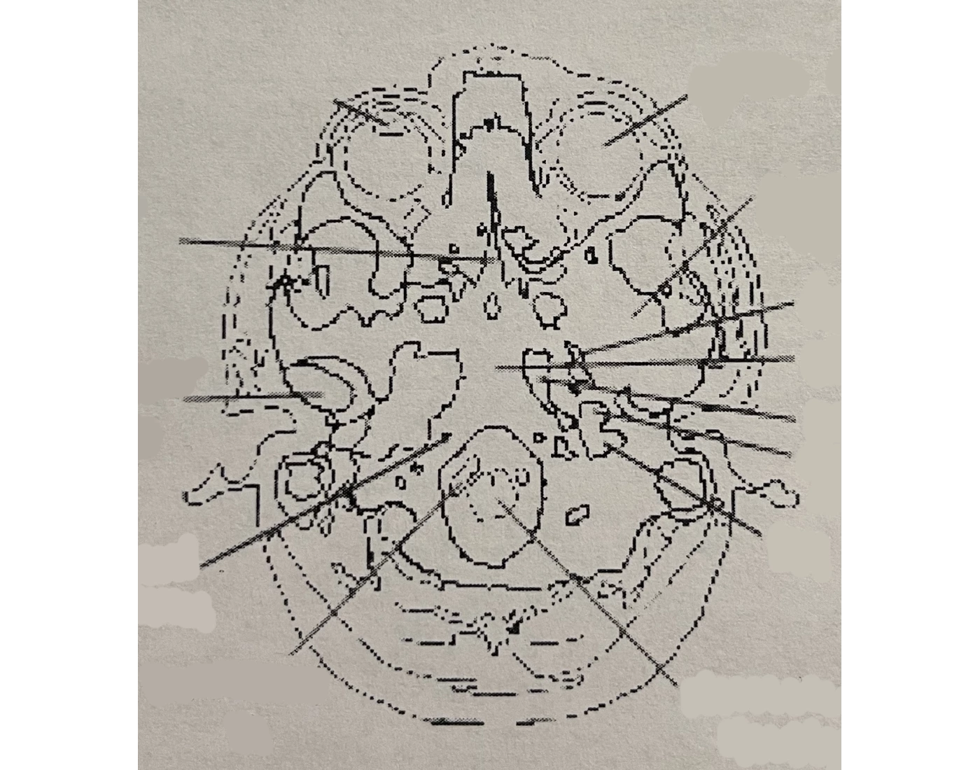 Ct Scan Worksheet.pdf Axial CT brain slice 1 — Printable Worksheet