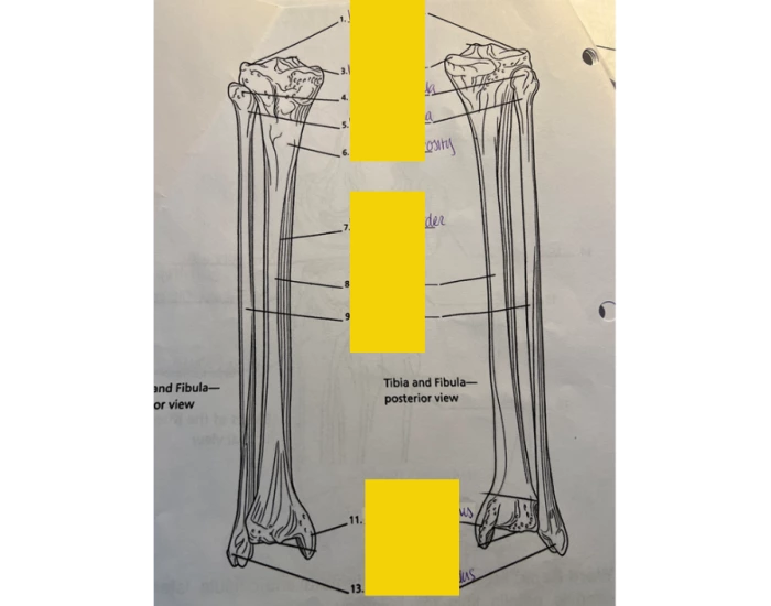 Apendicular Skeleton: Tibia and Fibia post+ant Quiz