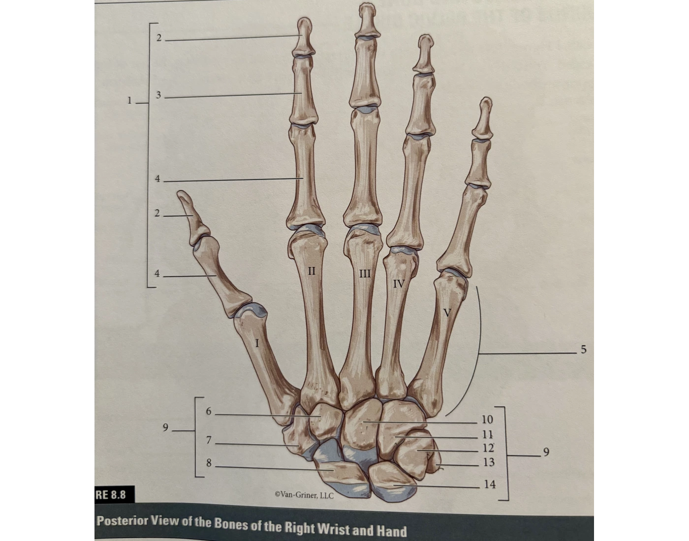 Right Risk Hand Right Wrist & Hand Quiz