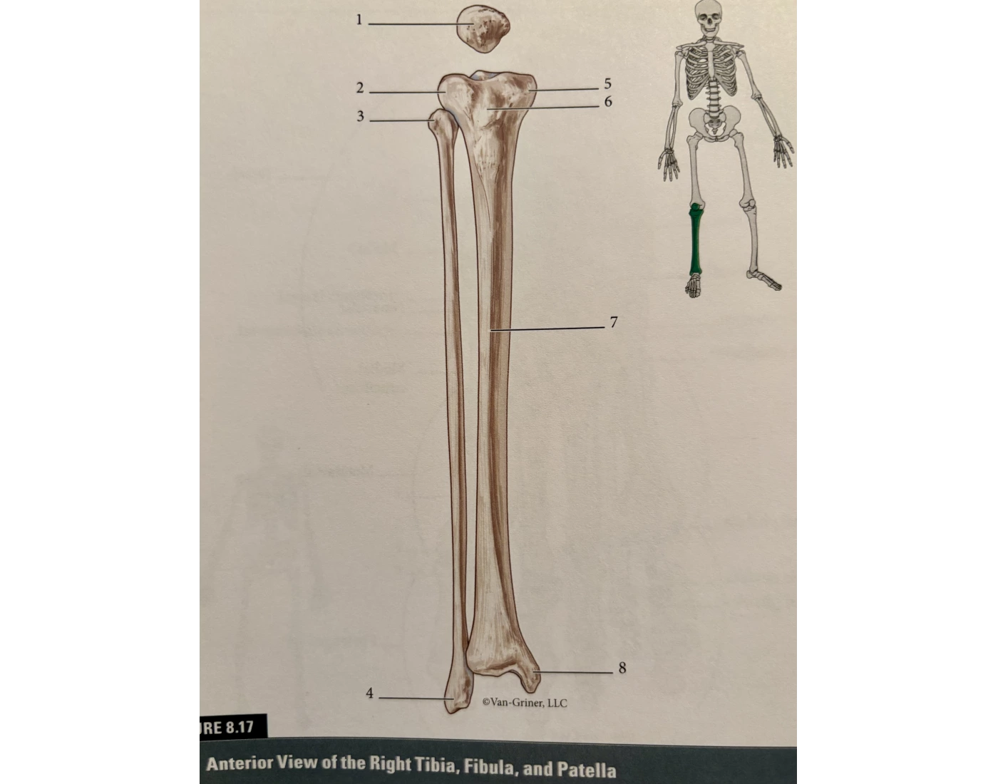 Right Tibia, Fibula & Patella Quiz