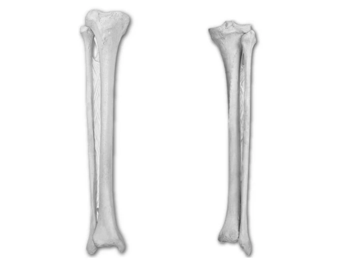 Tibia & Fibula Labeling Practice — Printable Worksheet