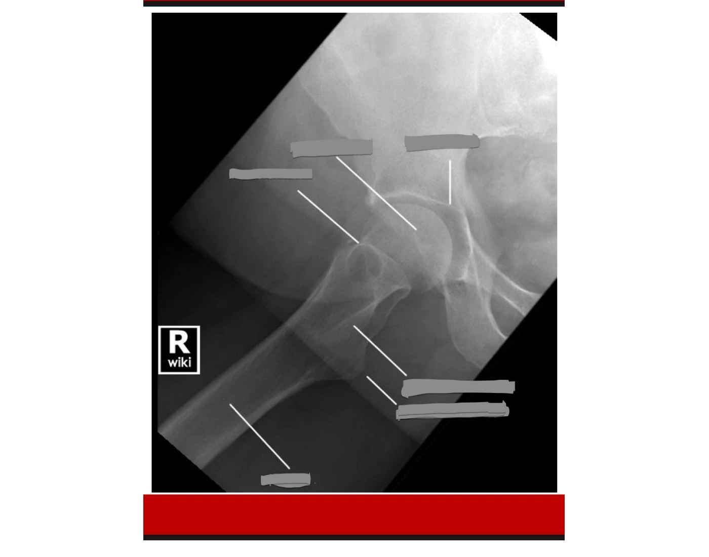 Frog Lateral Modified Frog lateral hip (image critique) Quiz