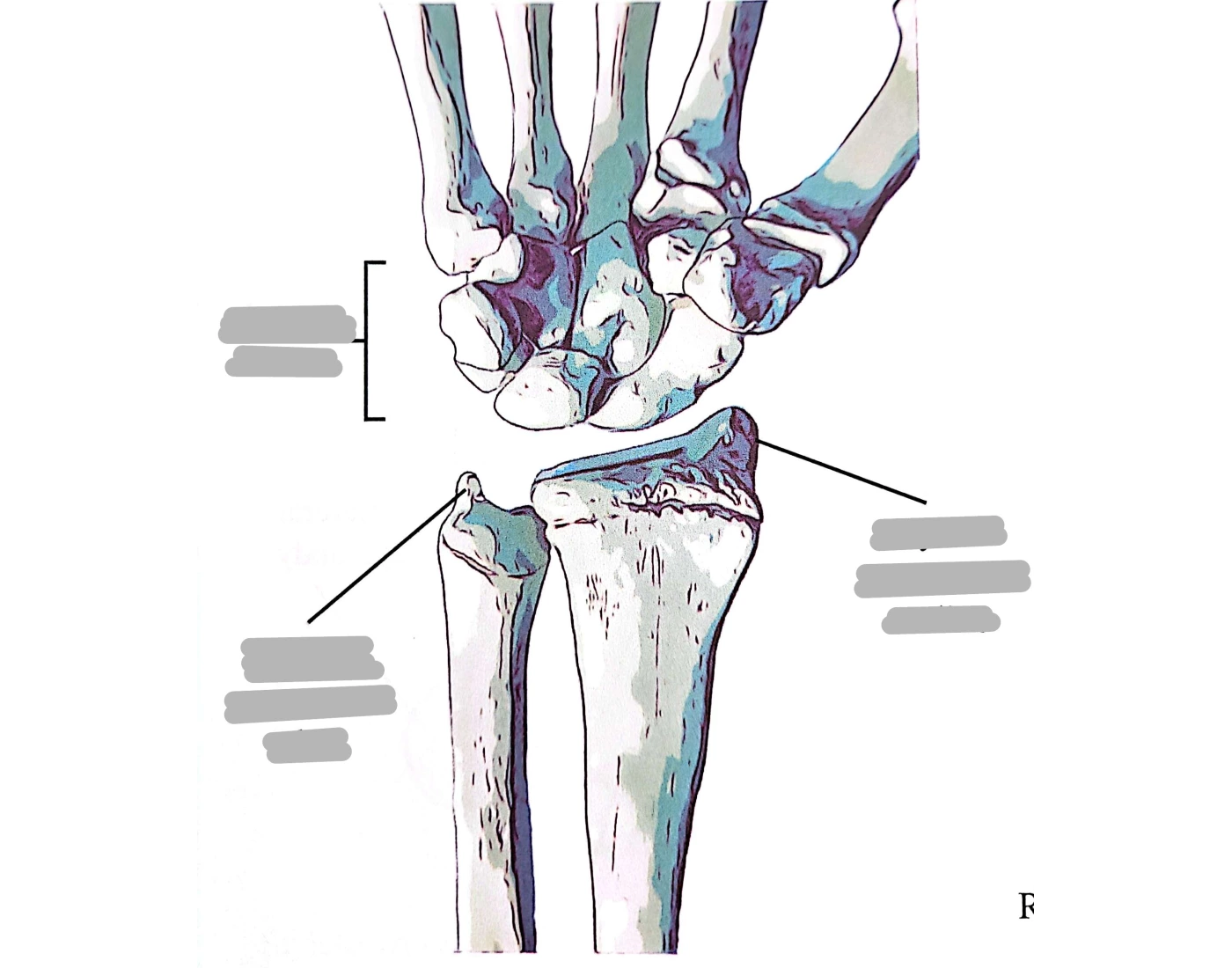 Carpal bones. Distal end of right radius and ulna — Printable Worksheet