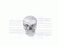 Anterior Skull