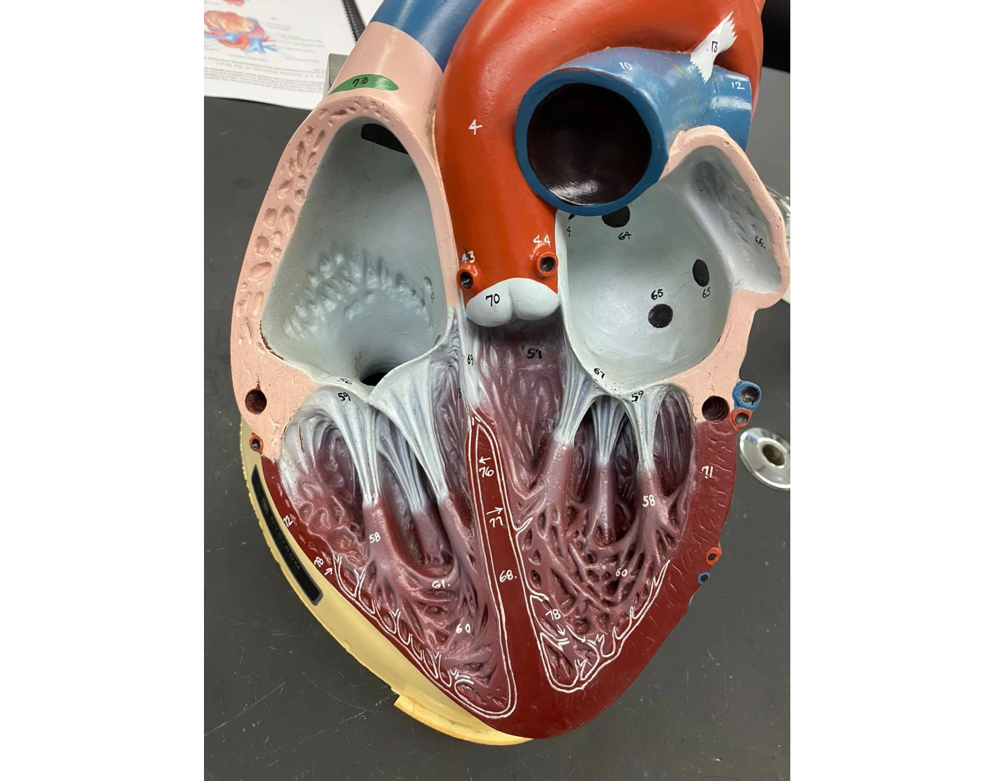 Internal View Examples other internal view of heart Quiz