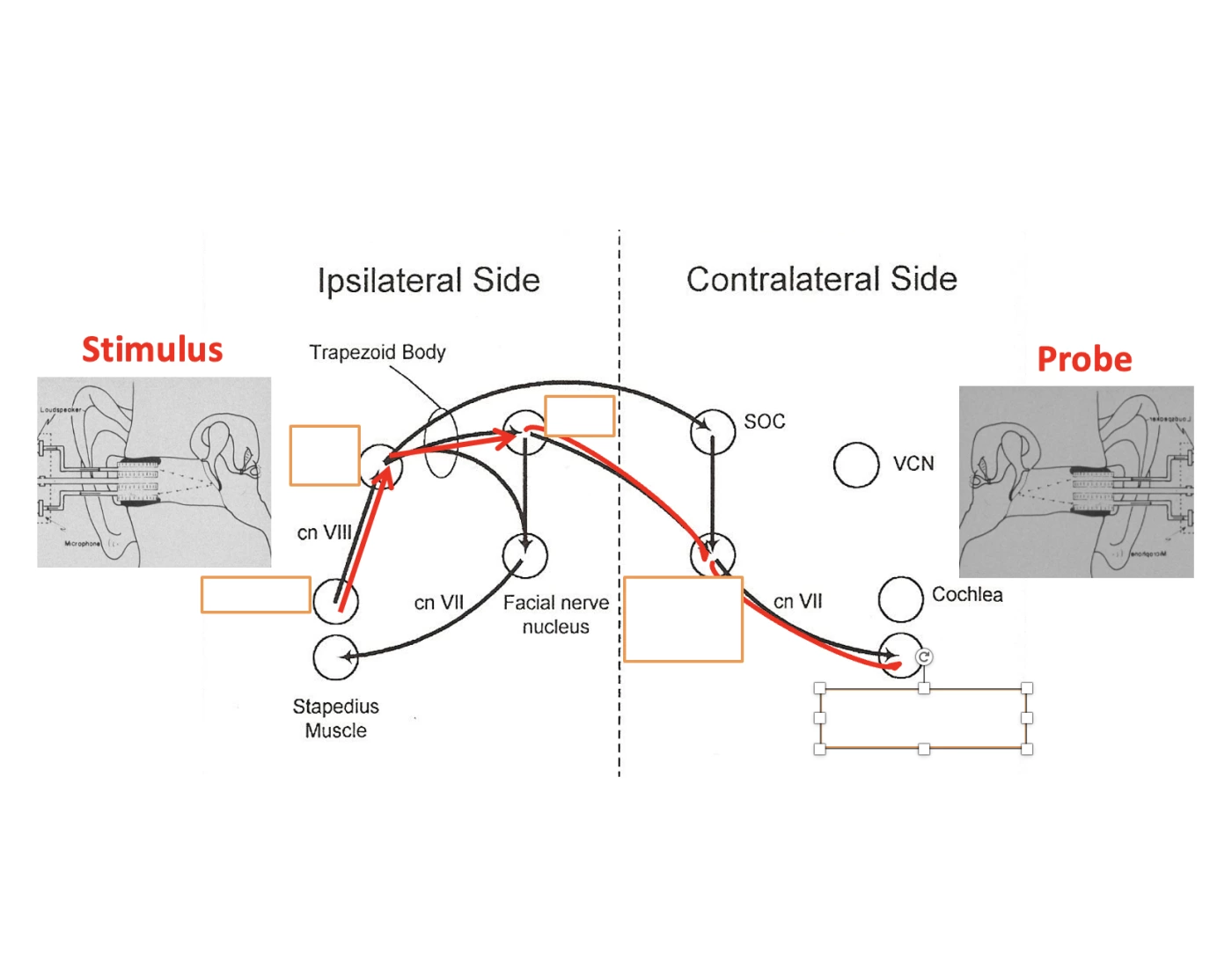 Contralateral Waveform Contralateral Acoustic Pathways Quiz