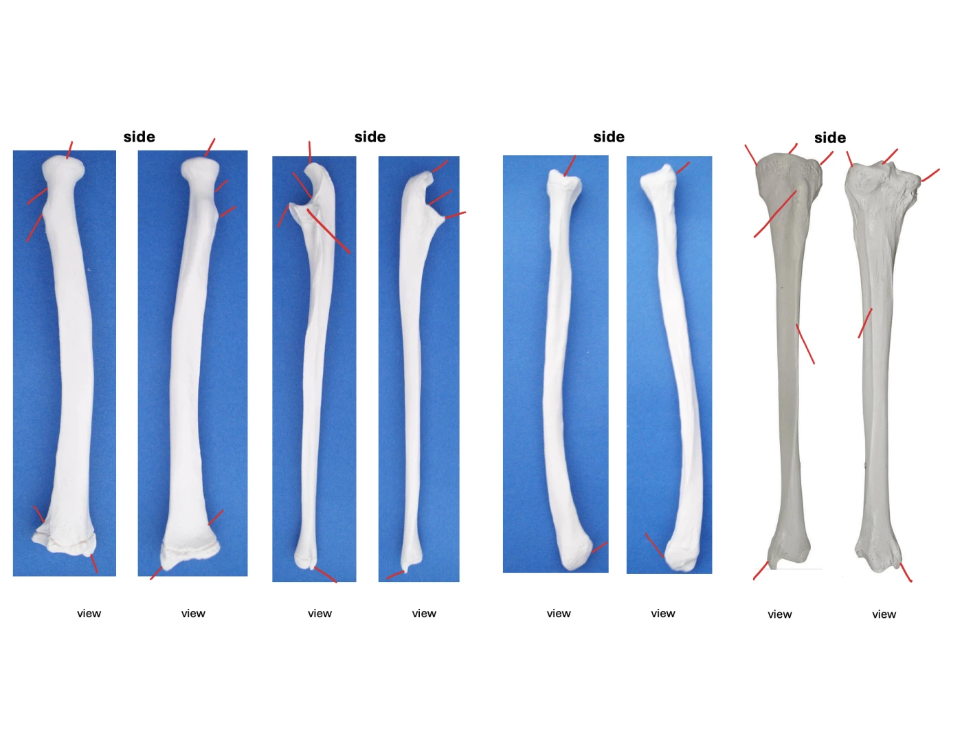 radius + ulna + fibula + tibia Quiz