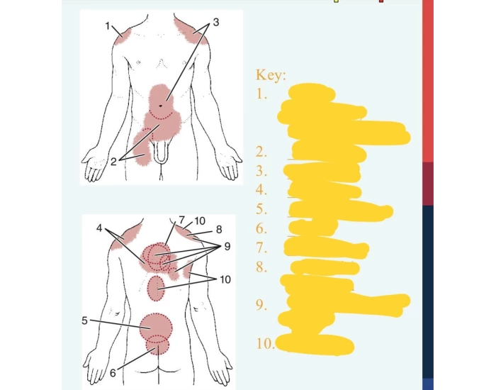 Pain Pattern For Rls Pain referreal patterns Quiz