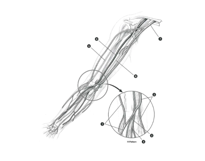 Veins Pattern H-pattern antecubital veins — Printable Worksheet