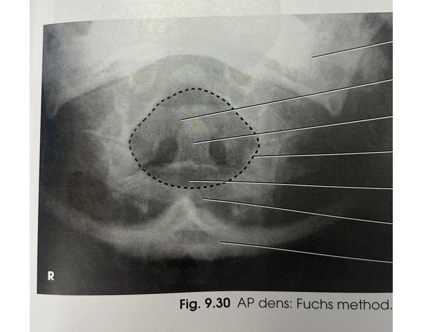 fuchs xray — Printable Worksheet