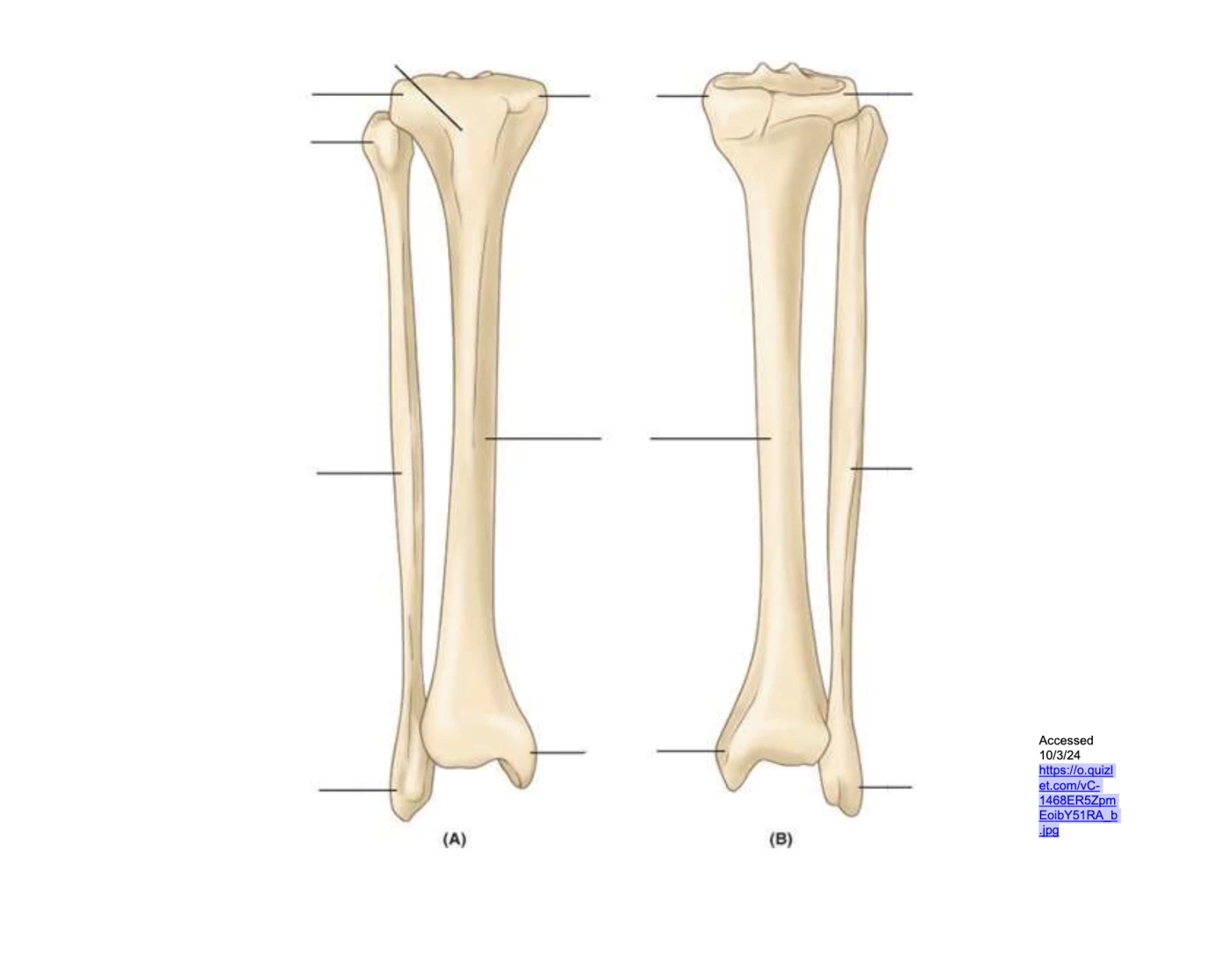 bony landmarks of tibia and fibula — Printable Worksheet