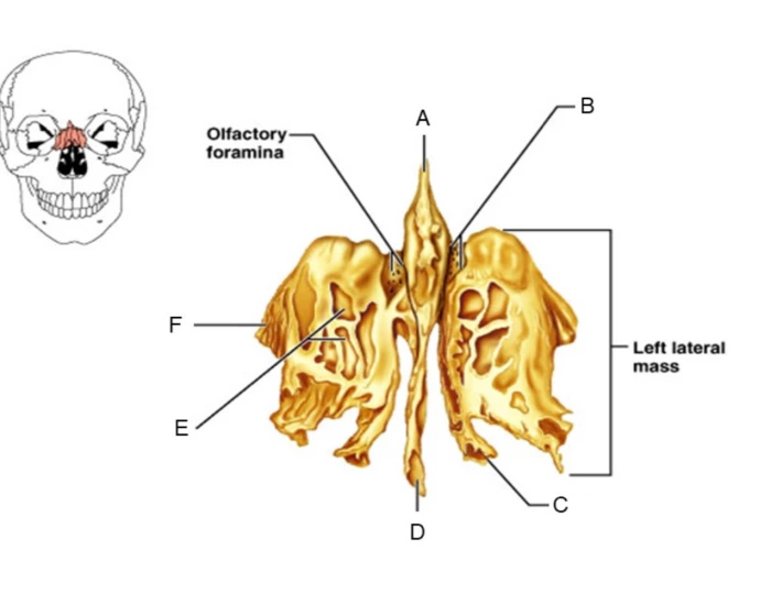 Ethmoid Bone Structure Printable Worksheet