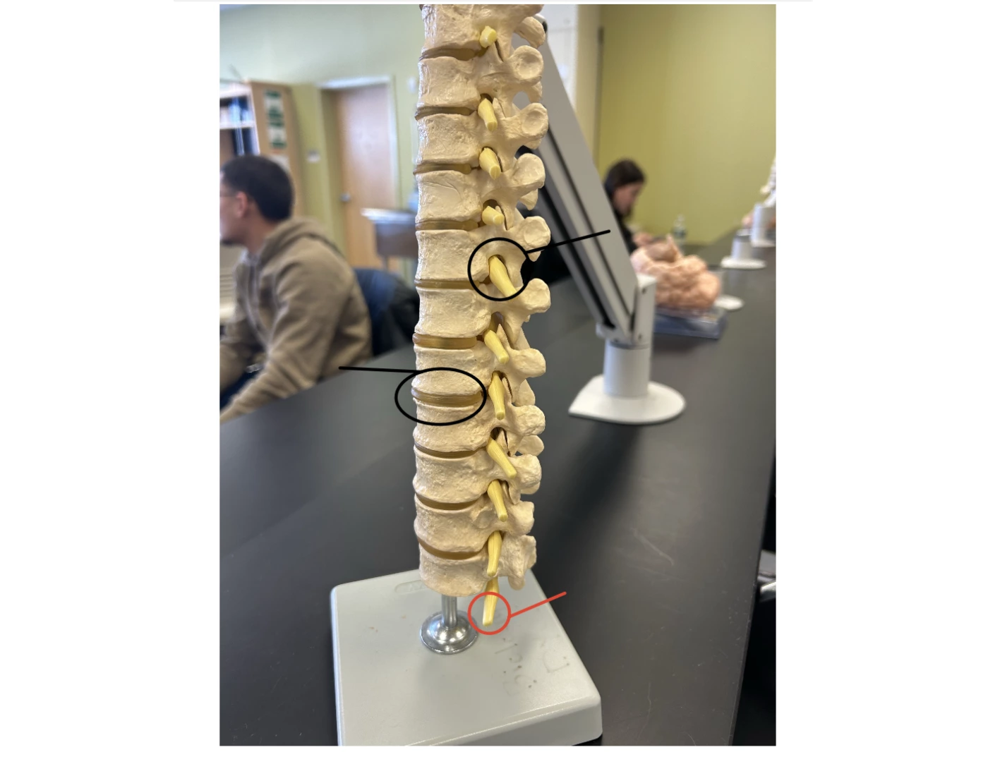 Spinal Column Point Spinal Column Model — Printable Worksheet
