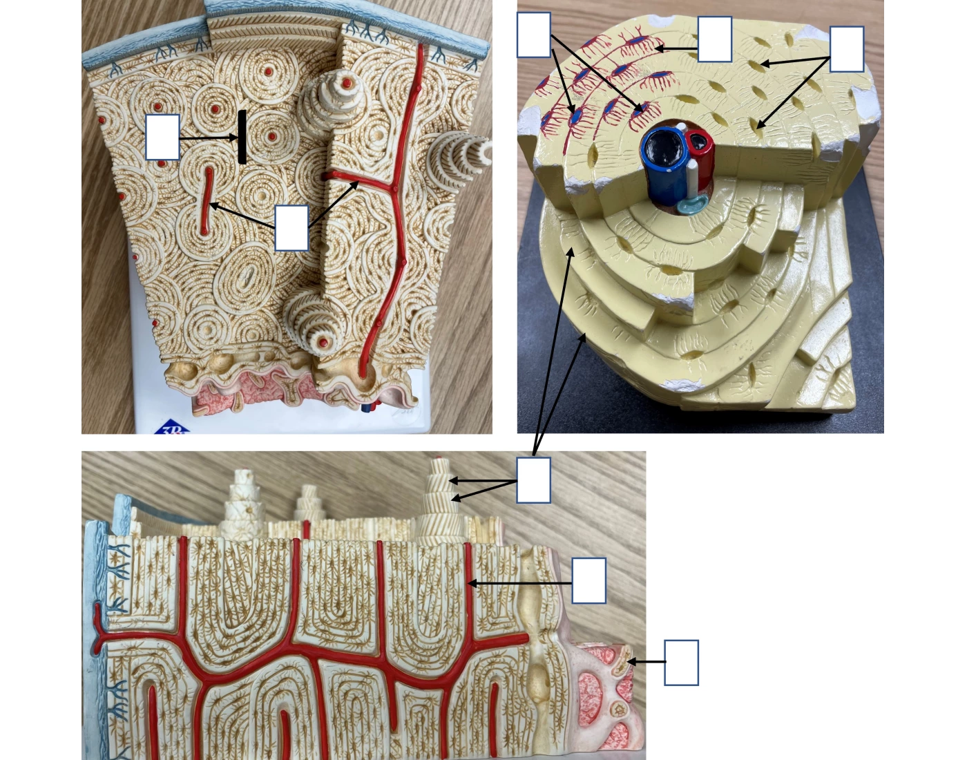 Lab #4- Microscopic Structure of Compact Bone — Printable Worksheet