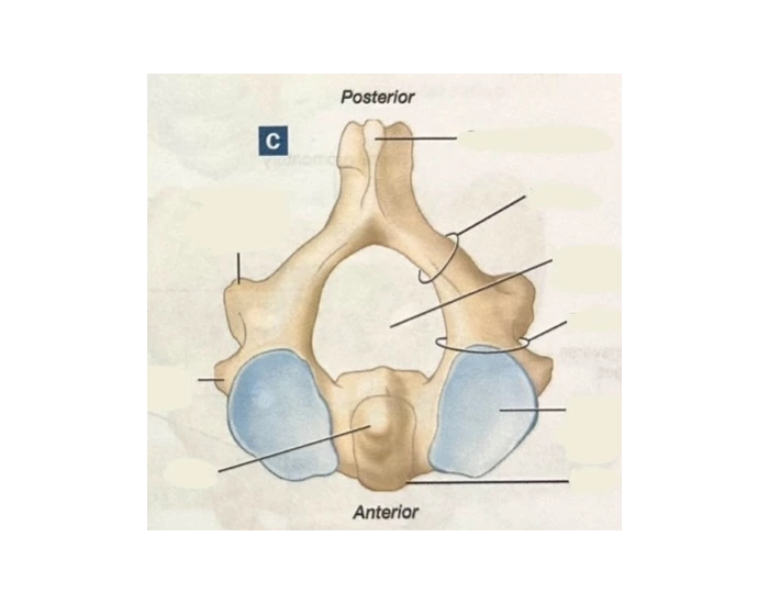 Anatomy of Axis Vertebra (C2) — Printable Worksheet