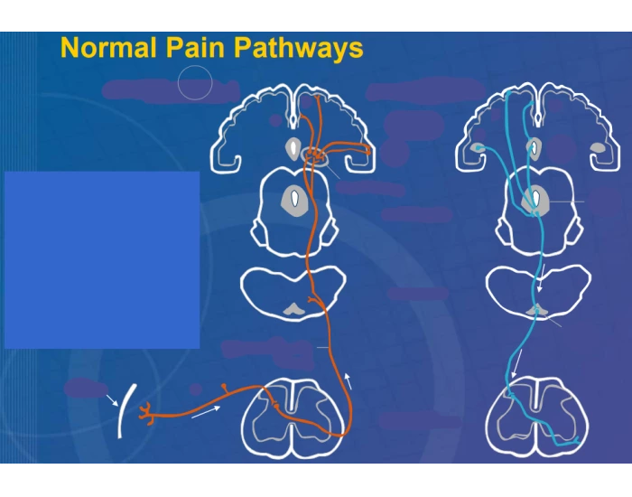 Normal Pain Pathways — Printable Worksheet