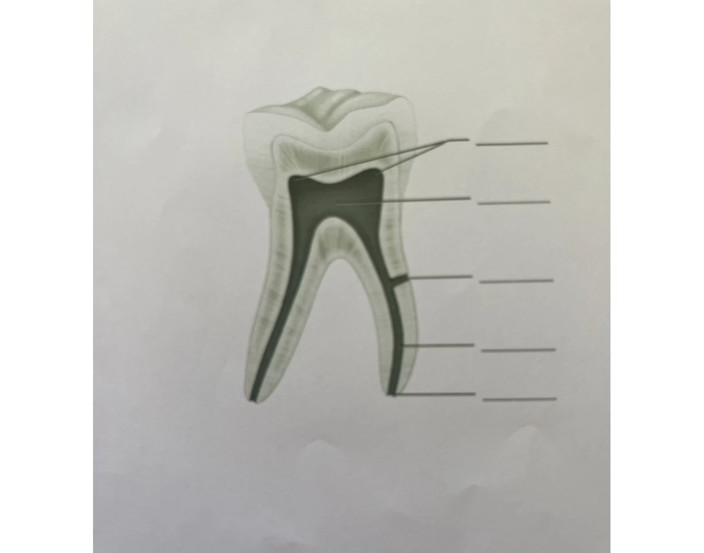 DENTAL PULP Quiz