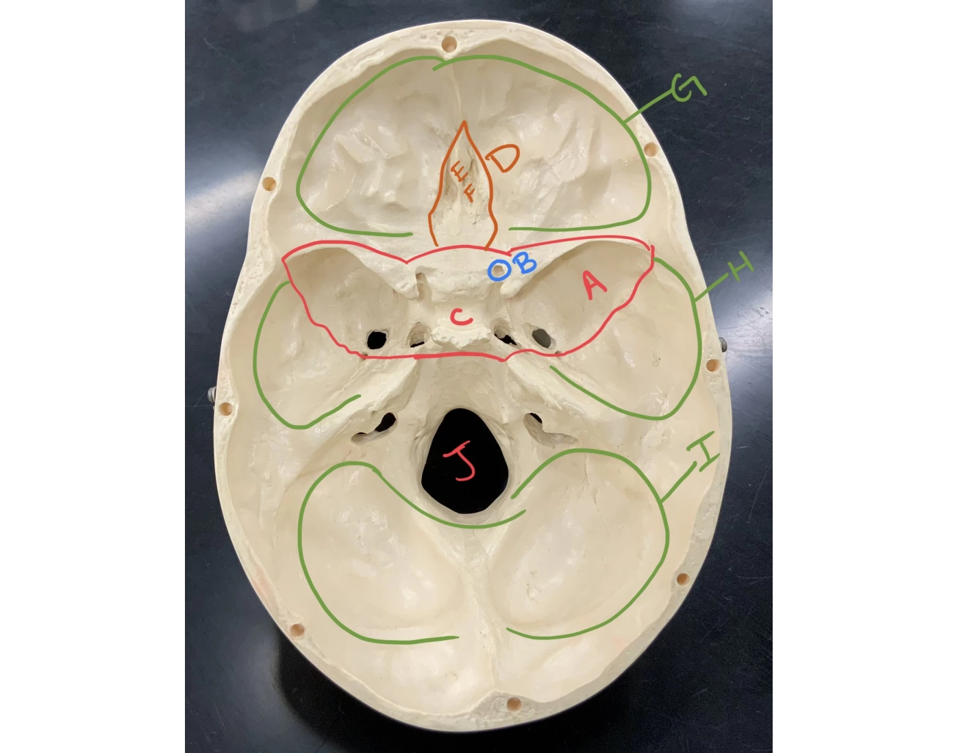 Skull, interior/superior view Quiz