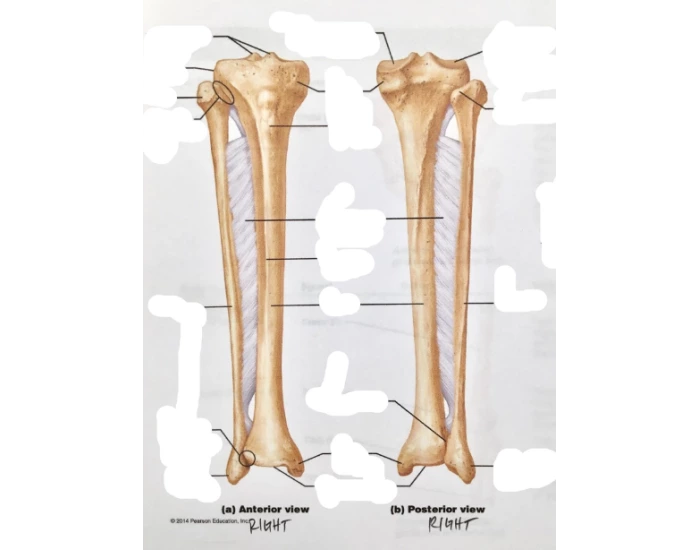 Labeling Tibia and Fibula — Printable Worksheet