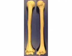 humerus labeling quiz