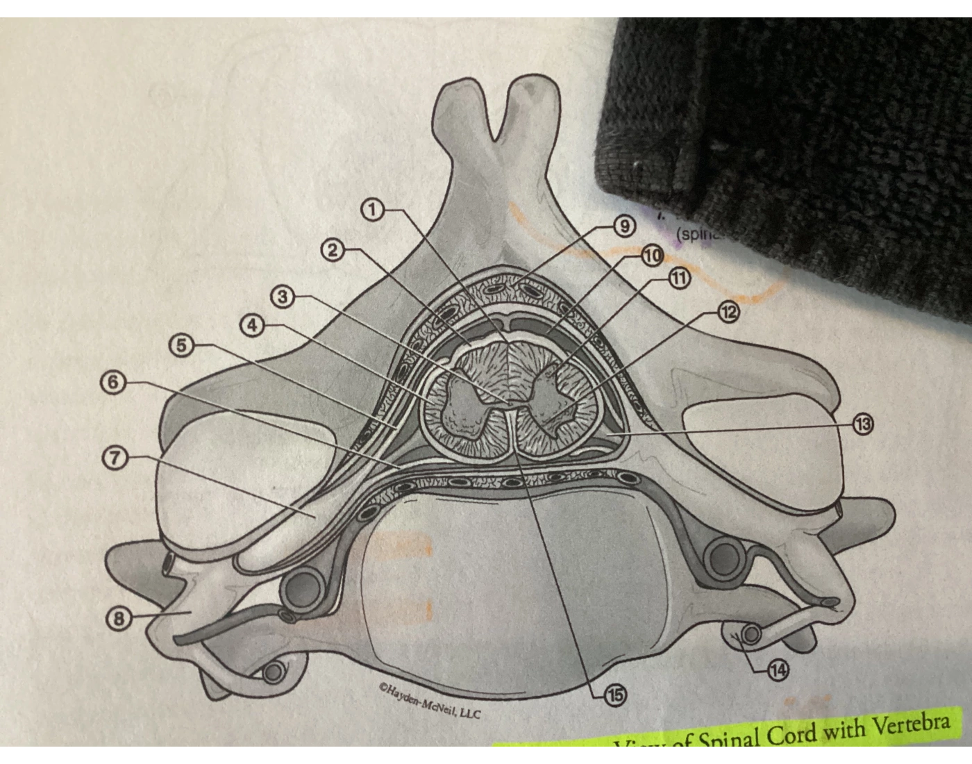 Viewing Transversely Transverse view of spinal cord with vertebra — Printable Worksheet