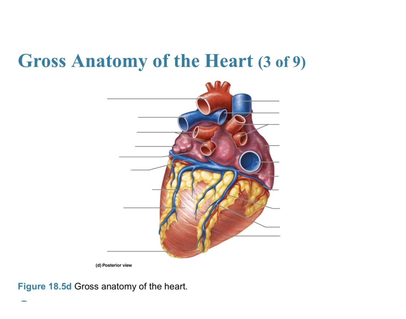 Gross Anatomy of the Heart Figure 18.5d Quiz