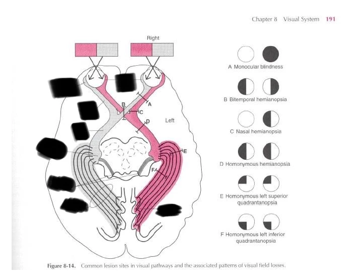 Behd Visual system Quiz