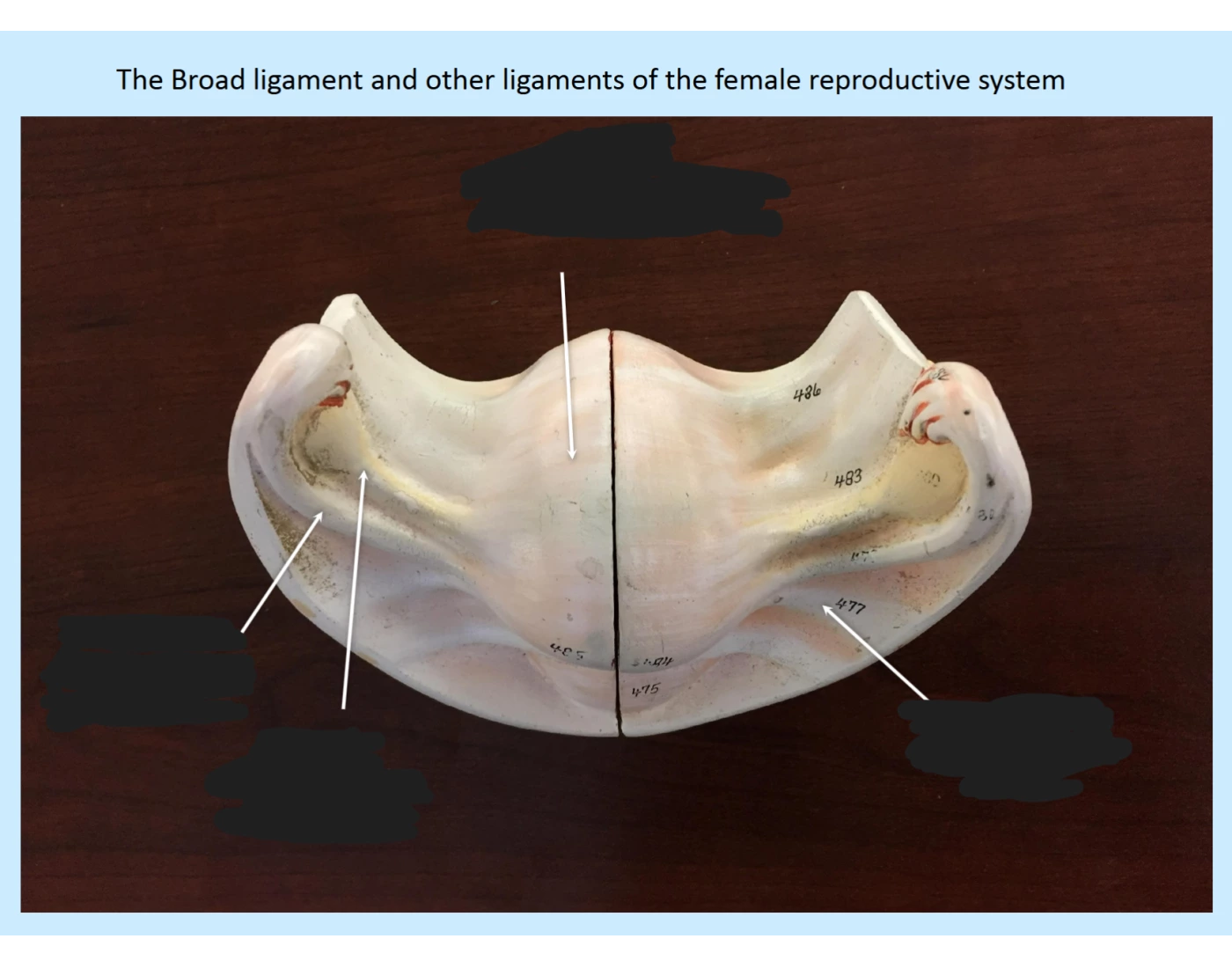 Ligaments of Female Repro System — Printable Worksheet