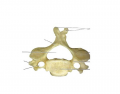 Superior view of cervical vertebrae