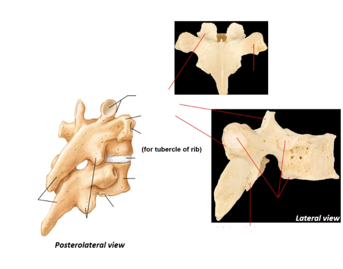 Thoracic Vertebrae 12 Printable Worksheet