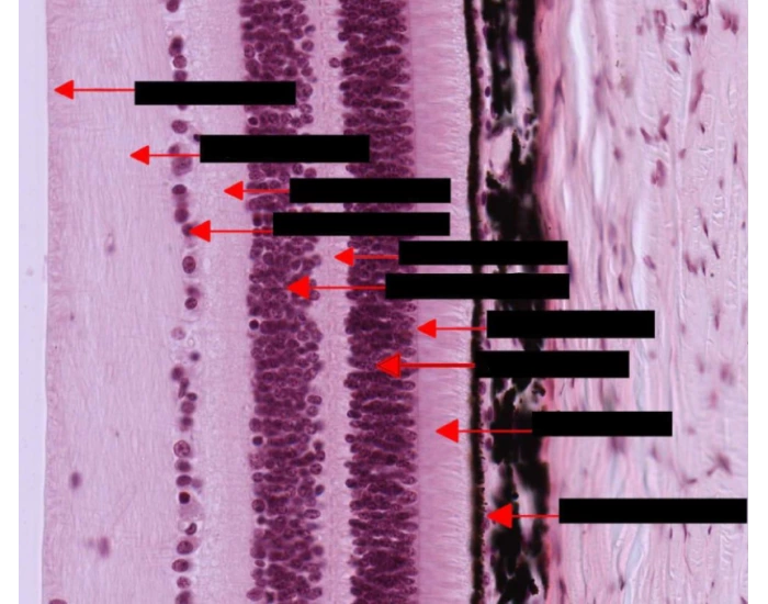 Printable Rods Science Rods and Cones Membrane Histology — Printable Worksheet