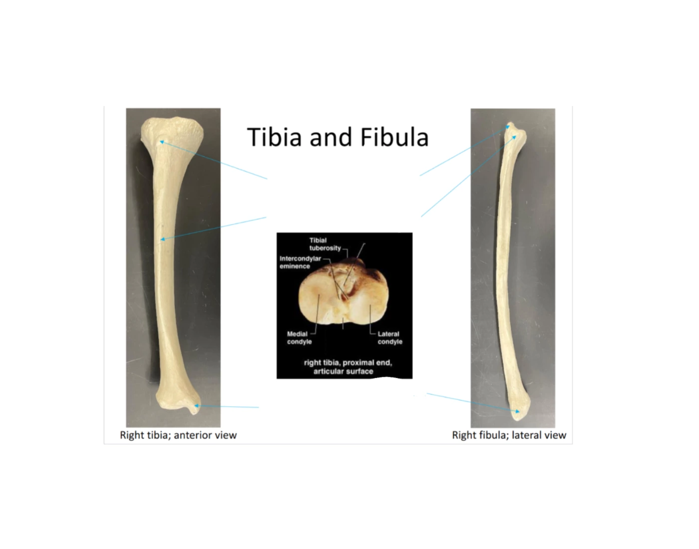 tibia and fibia Quiz