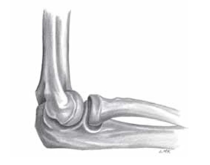 Polliard Lateral view of radioulnar joint Quiz