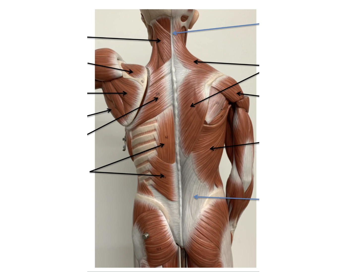 Deep Trunk superficial and deep trunk muscles Quiz