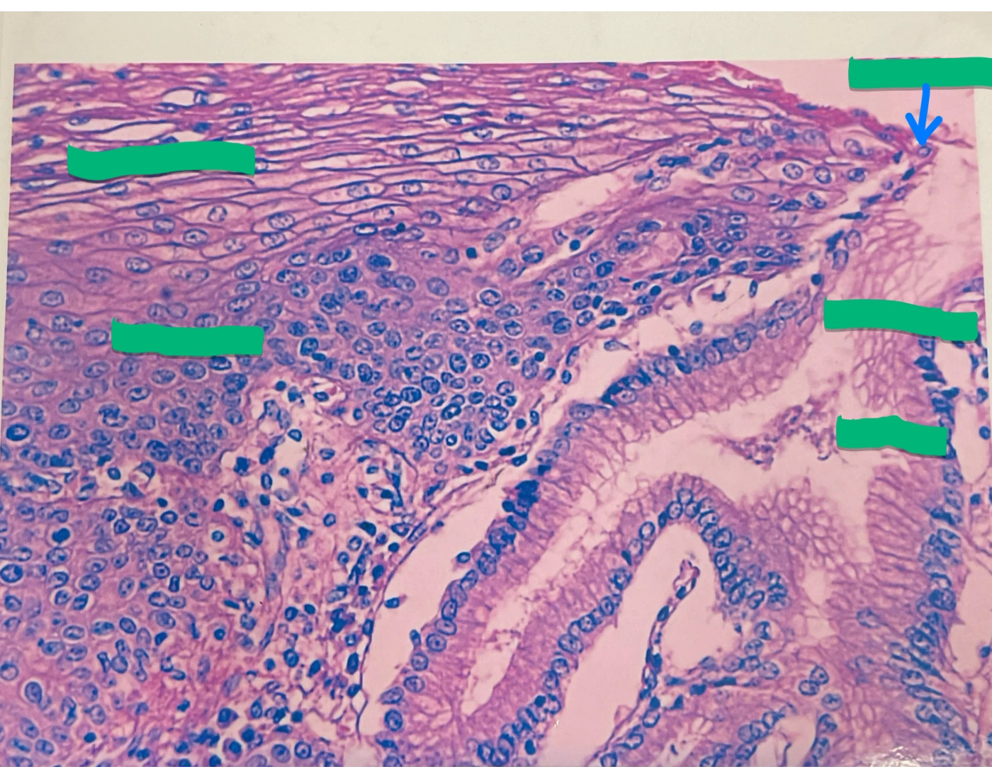 Normal Goj Histology: Gastro-Esophageal Junction Quiz