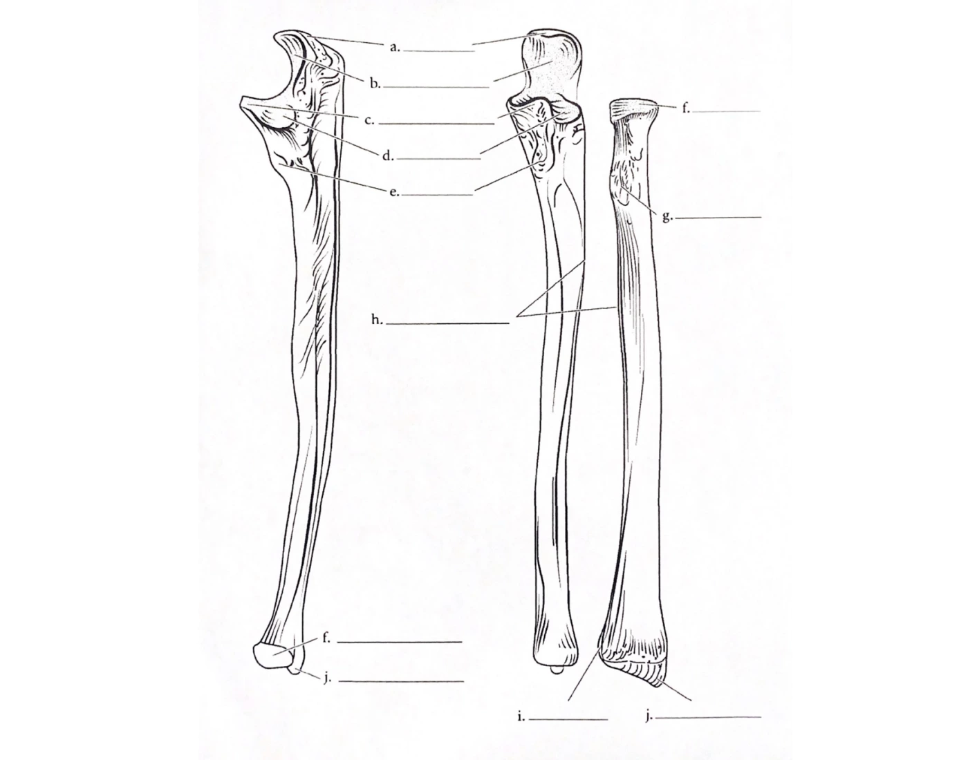 Radius With Labels ulna + radius label Quiz