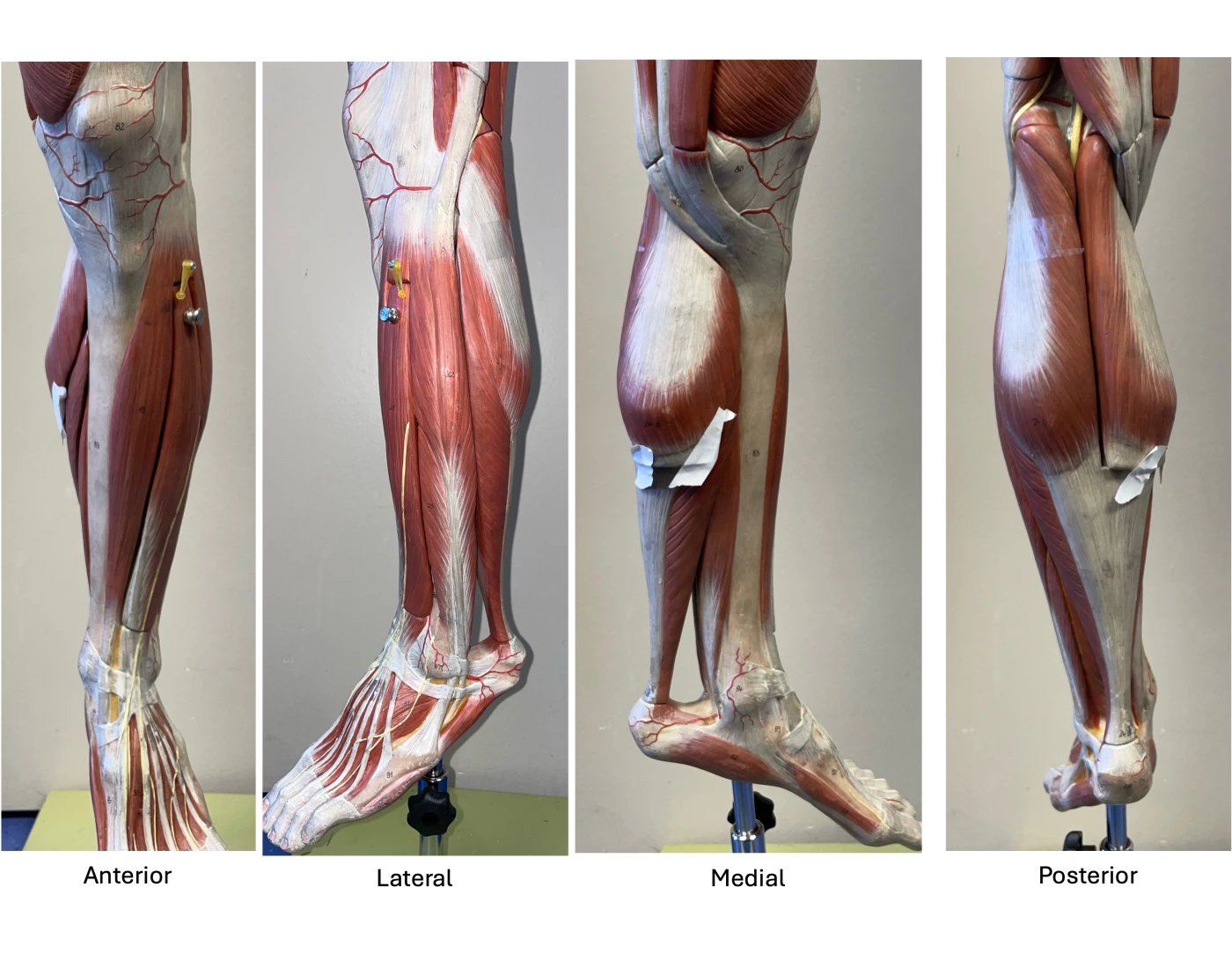 BIOL A111- Lab #6 Leg Model- Lower Leg Quiz