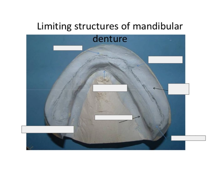 Limiting structures of mandibular denture Quiz