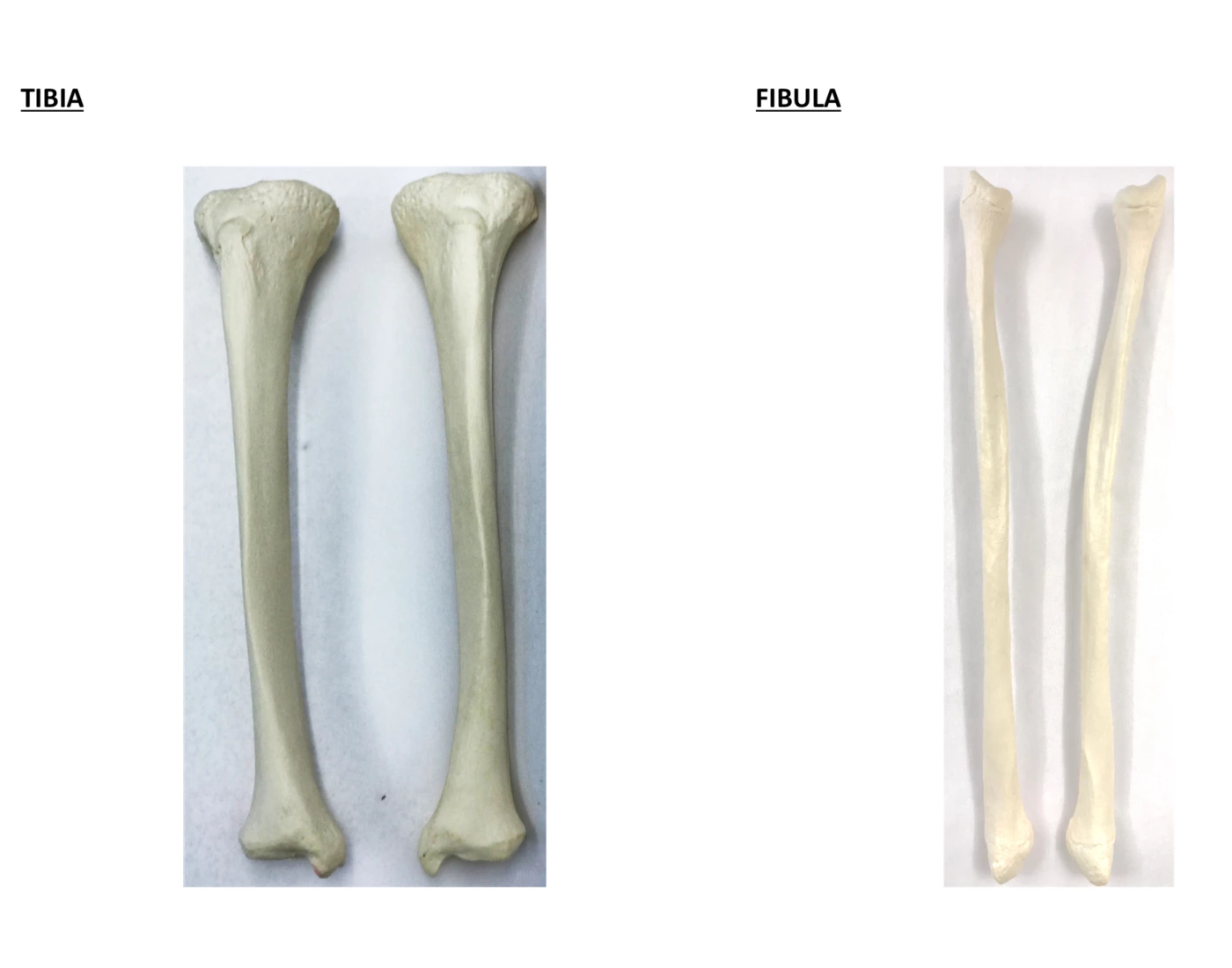 Tibia and fibula Quiz