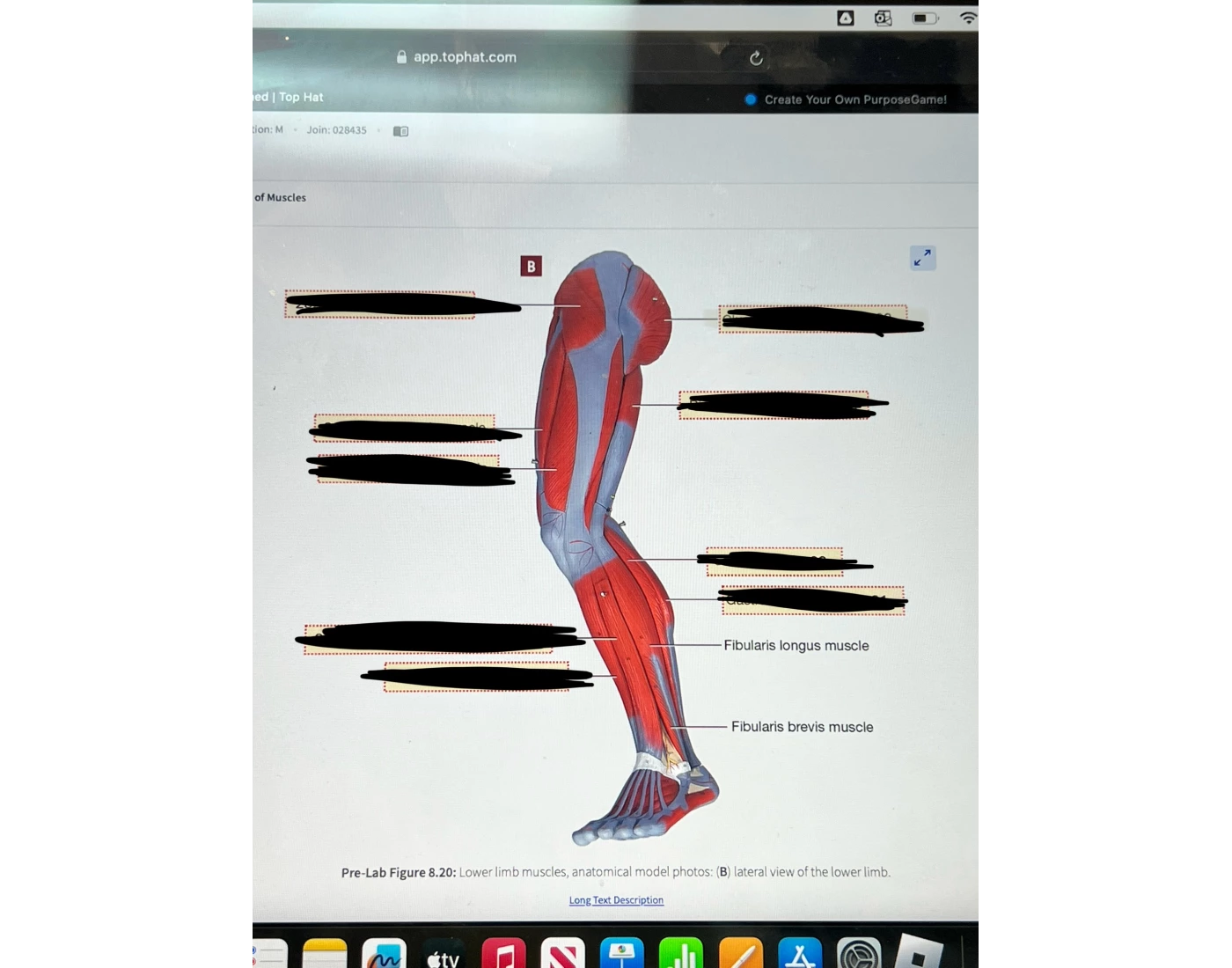 lower limb muscle leg Quiz