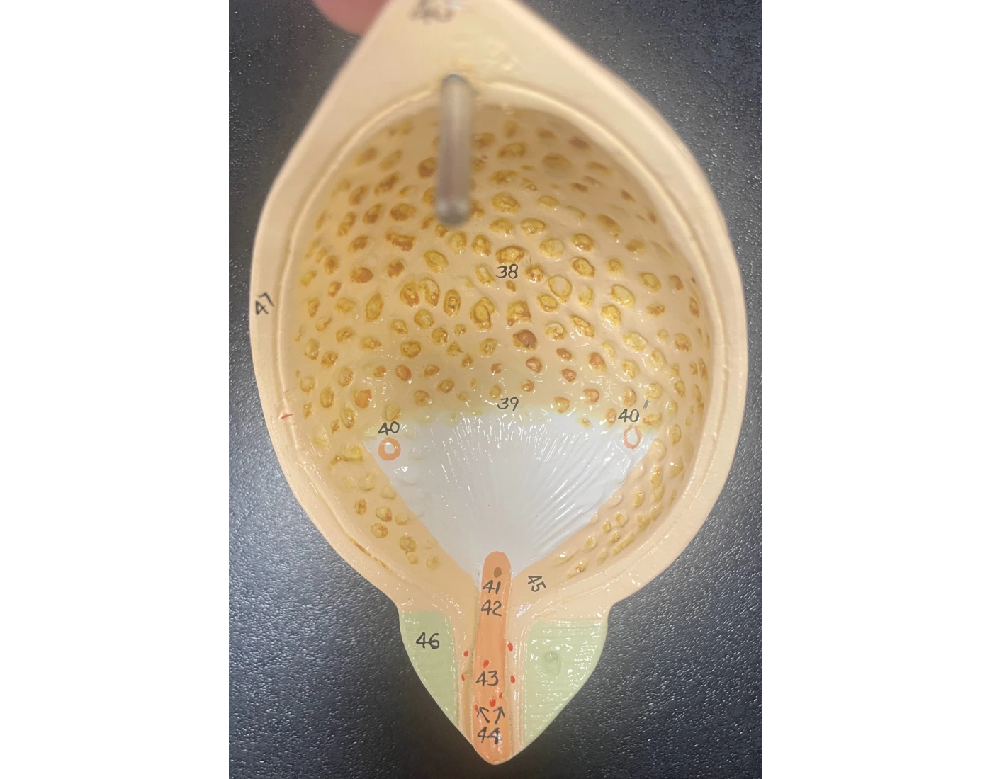 Bladder Game Urinary Bladder, Sectioned Quiz