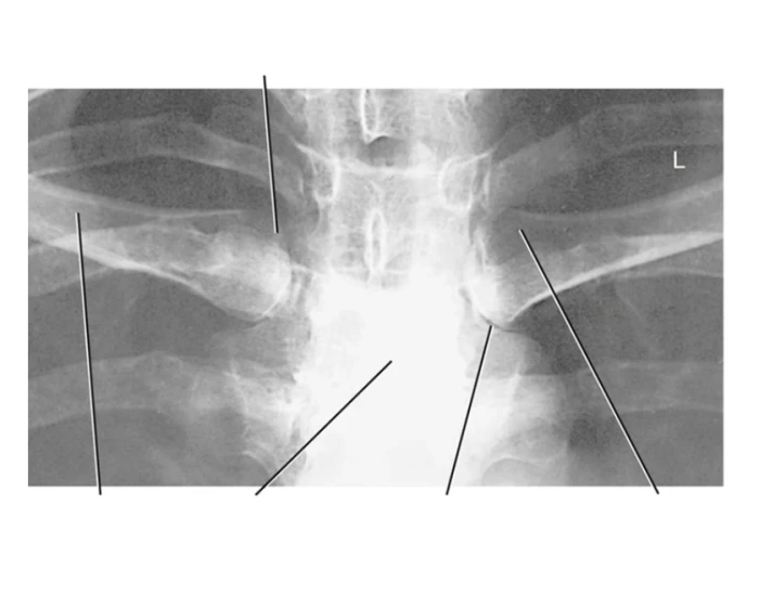 Sc Joint Testing SC joints Quiz